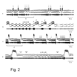 Fig2.gif (5027 bytes)